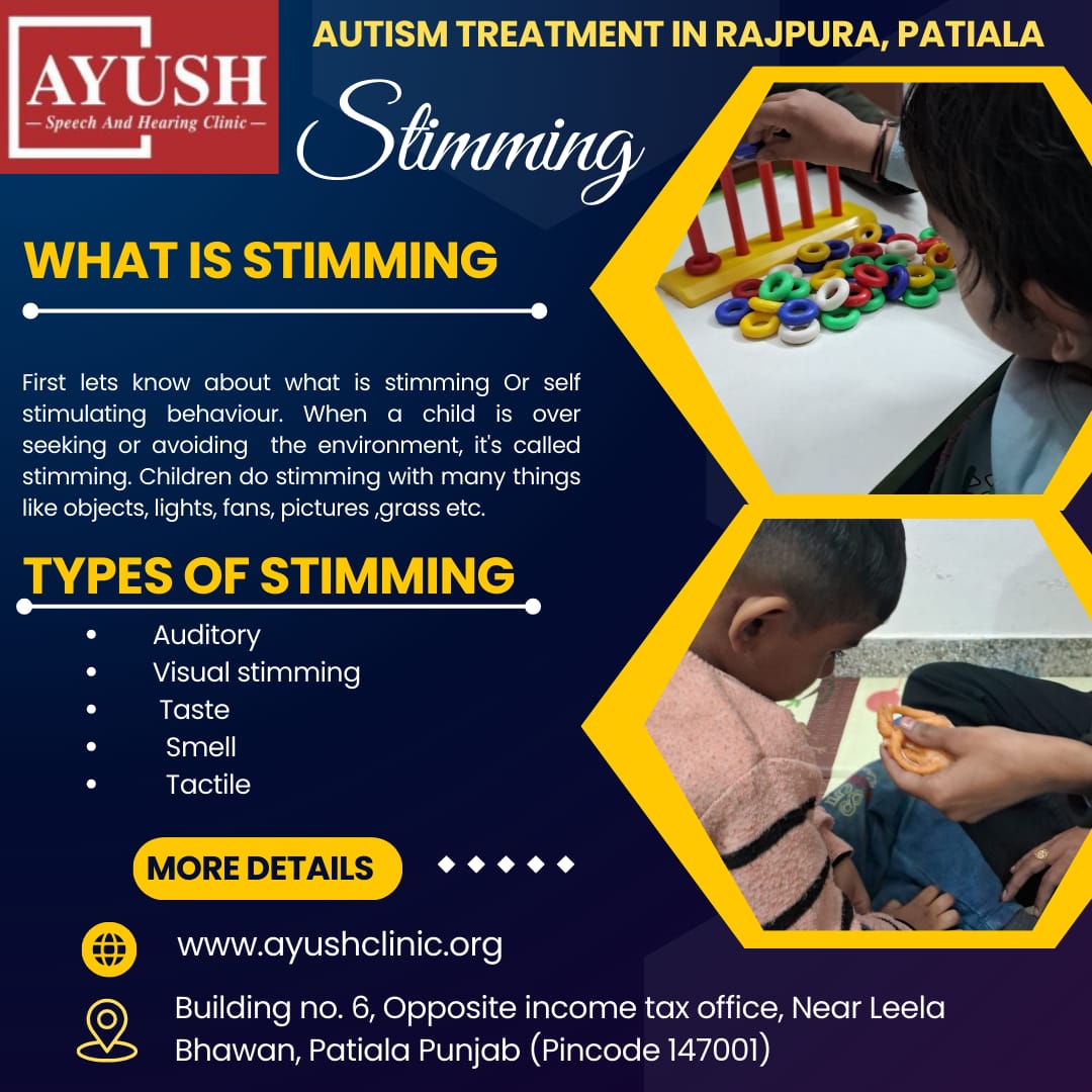 What is Stimming and how we differentiate and resolve it? What is Stimming and how we differentiate and resolve it?